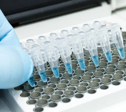 A researcher put a strip of 8 PCR tubes on the thermal cycler –thermocycler – for DNA amplification