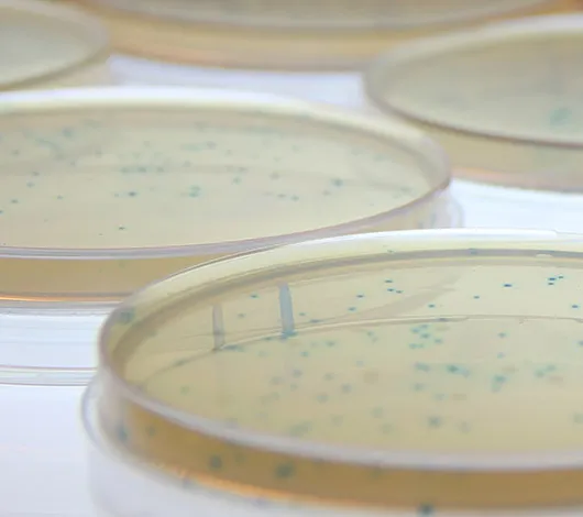 Photo of phage plates