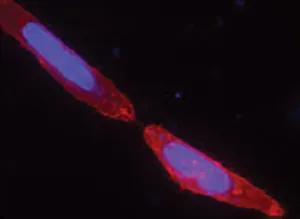 Live U-2 OS cells transiently transfected with pSNAP-ADRβ2