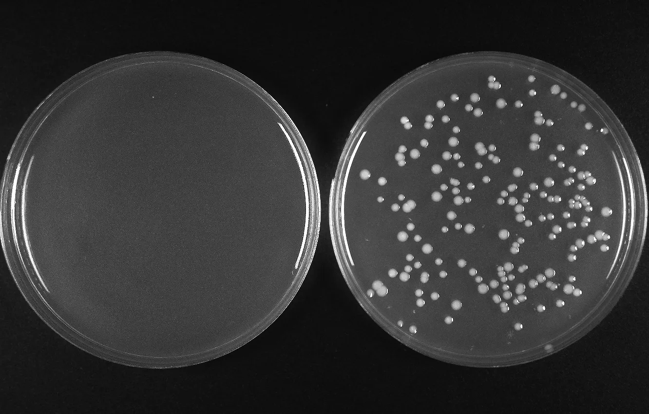 Plate with 50 bp insert (Left: control, with vector backbone only, Right: contains PCR insert)