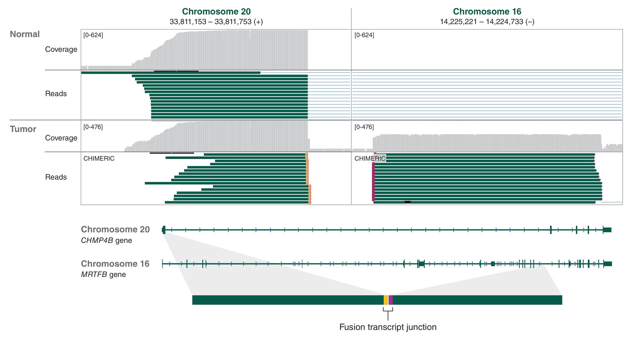 Coverage and read analysis for tumor fusion transcripts Chromosome 20 and Chromosome 16