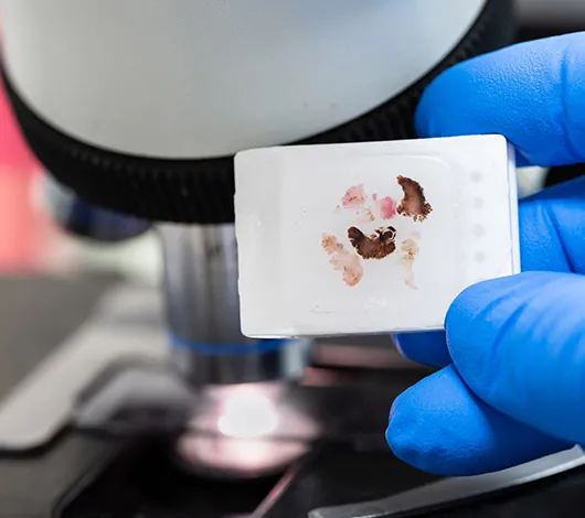 Glove holding paraffin block with tissue in front of microscope