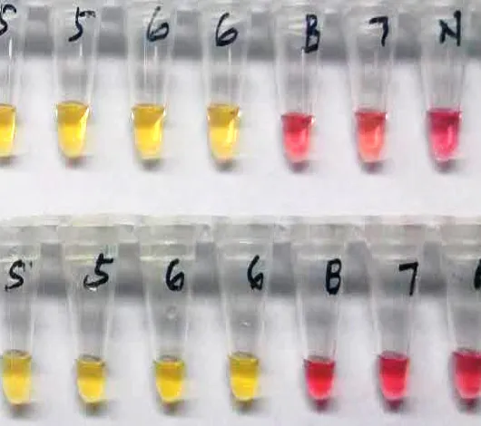 Photo of SARS-CoV-2 detection from COVID-19 