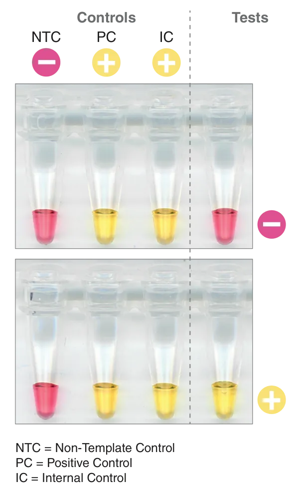 Examples of positive and negative results for SARS-CoV-2 using colorimetric LAMP
